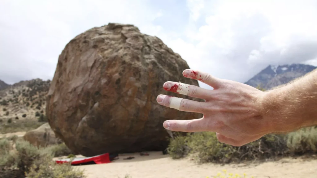 Bouldering. Prevention Of Injuries